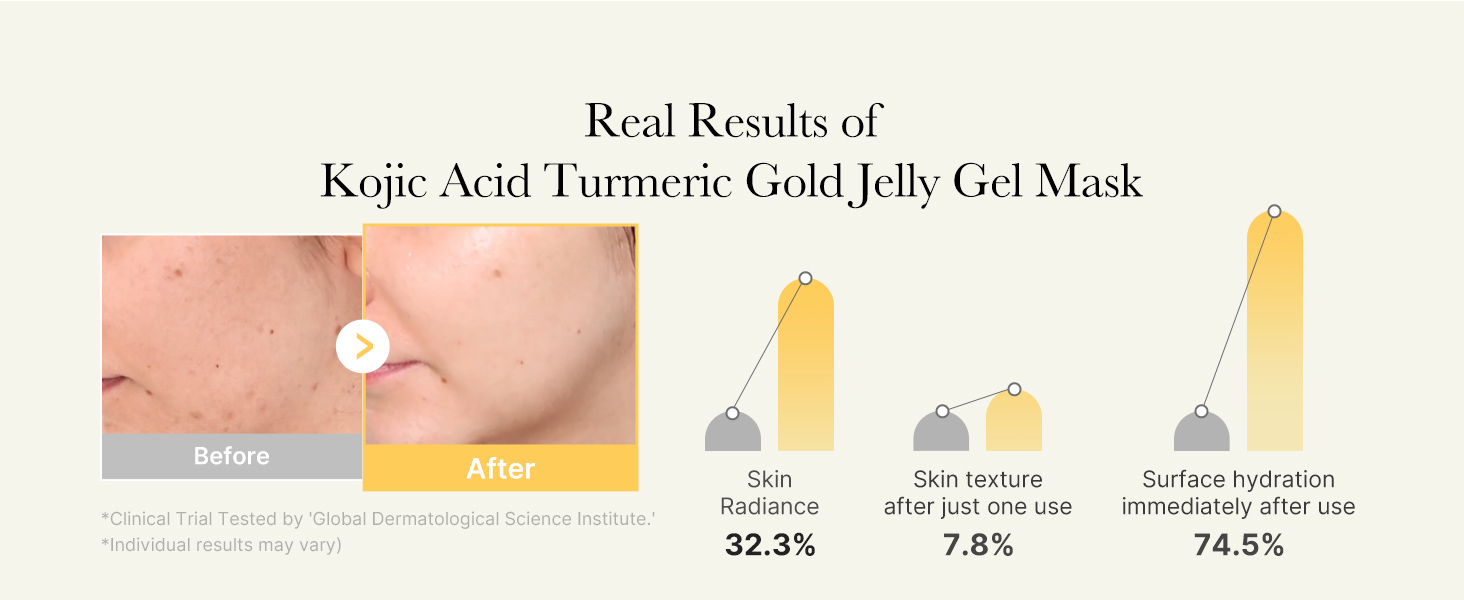 Kojoc Acid Turmeric Gel Mask>3